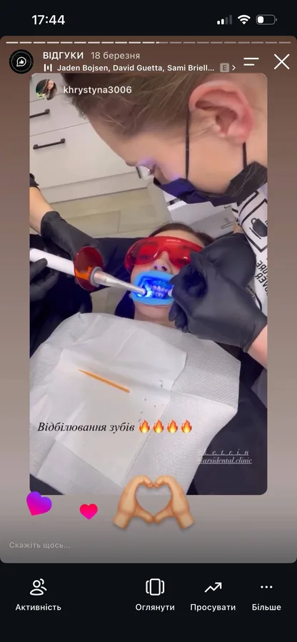 Догляд та профілактика