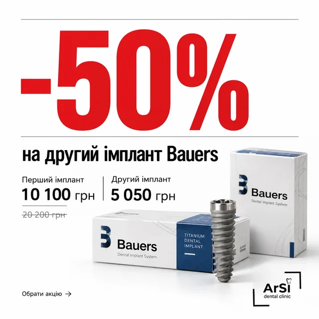 Акція ArSi Dental на другий імплант Bauers зі знижкою 50%