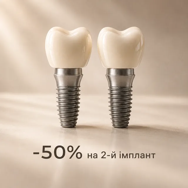 Акція ArSi Dental на другий імплант Neobiotech зі знижкою 50%